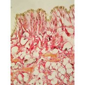 Weigert's Hematoxylin Solution B